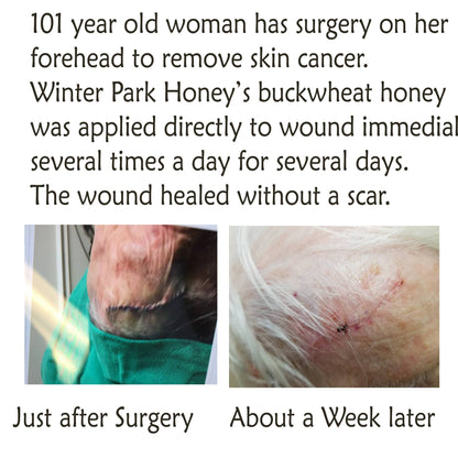 Buckwheat Honey - 16oz | Winter Park Honey (Pure Raw)